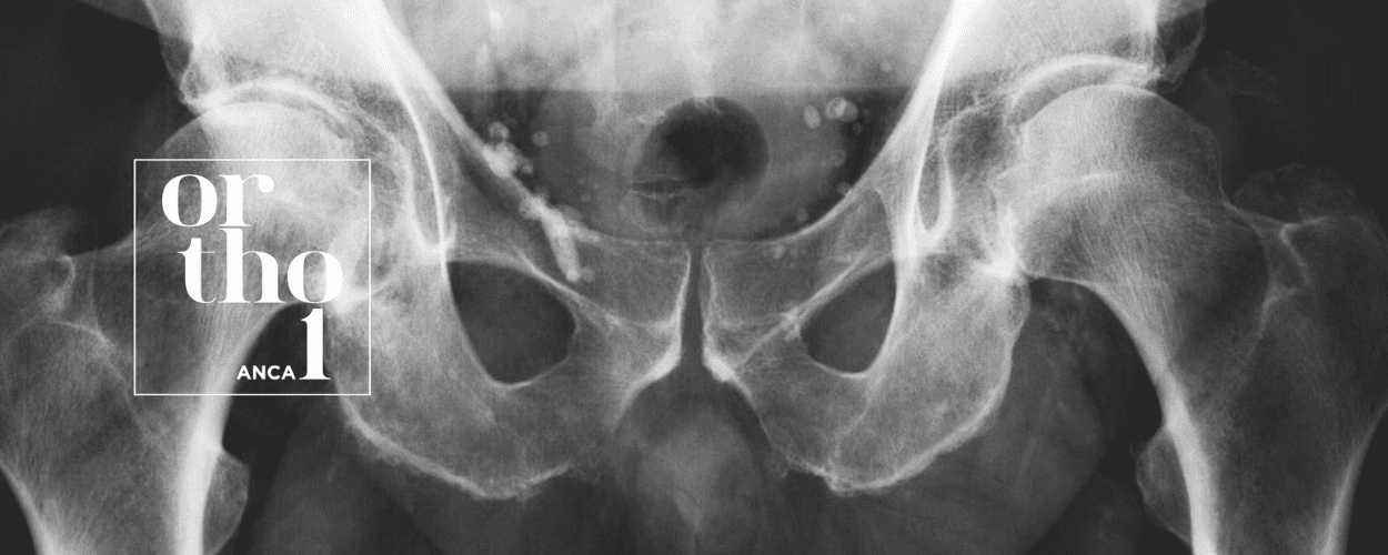 Ortopedia dell'anca - Ortho1 - Modena