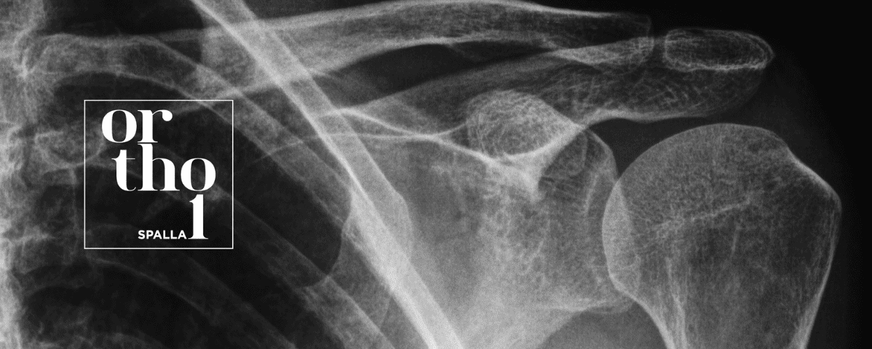 Ortopedia della spalla - Ortho1 - Modena